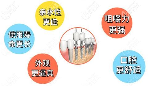 瑞士sic種植體優(yōu)勢 瑞士sic種植體優(yōu)勢