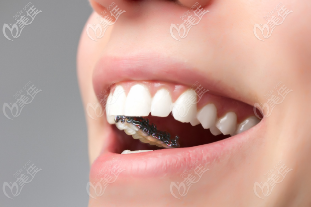 北京舌側矯正哪個醫(yī)生好?北京能做舌側矯正的醫(yī)院醫(yī)生都在這里了