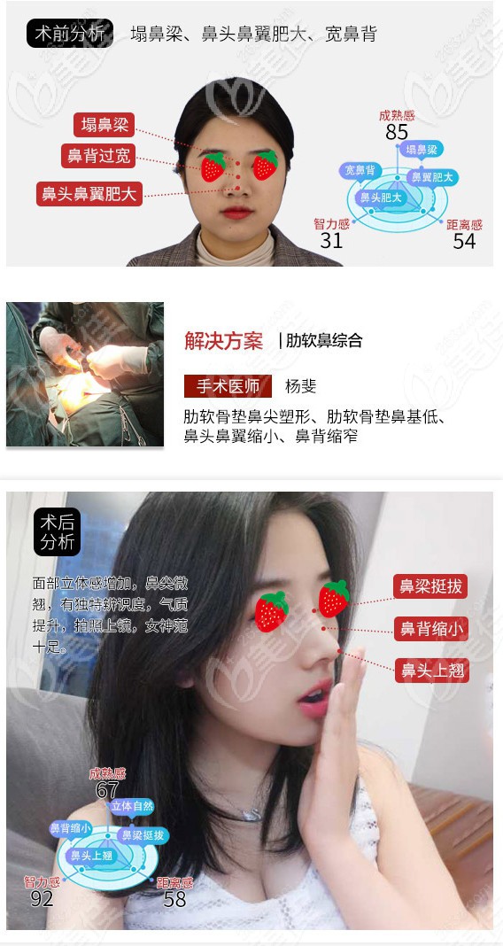 楊斐醫(yī)生案例偏自然