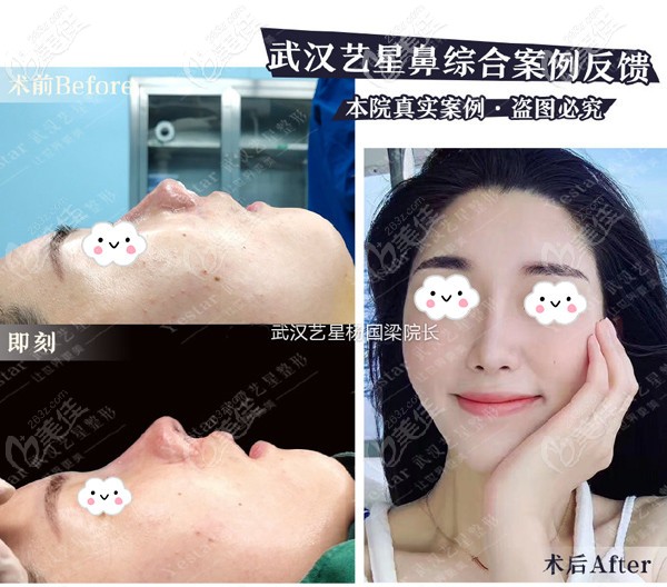 楊國梁醫(yī)生效果偏高挺