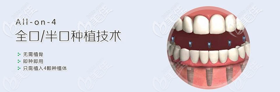 全口半口種植圖片