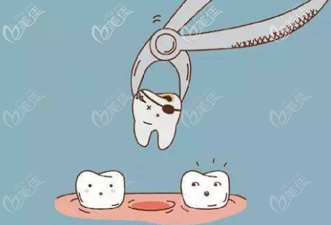 拔牙過程 拔牙過程