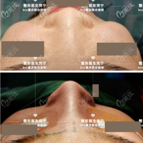 重慶聯(lián)合麗格黨寧做鼻子怎么樣 重慶聯(lián)合麗格黨寧做鼻子怎么樣