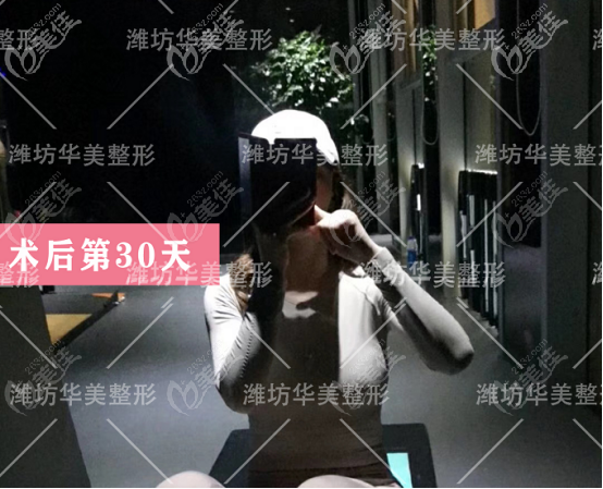 濰坊華美做隆胸的術后第30天狀態(tài)