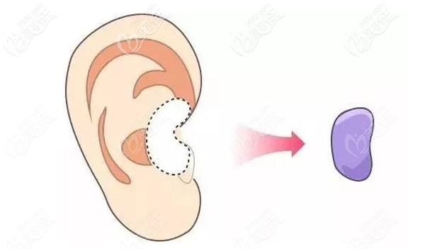 為什么說大理伊美東方麗人整形做鼻子好