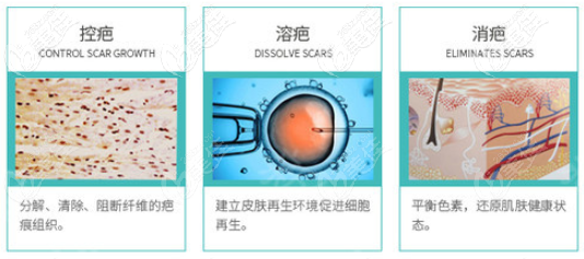 治療圖示 治療圖示