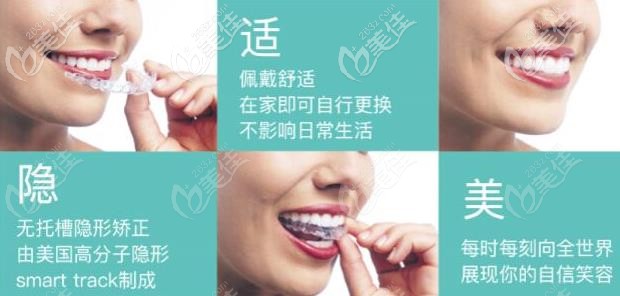 隱適美隱形牙套 隱適美隱形牙套