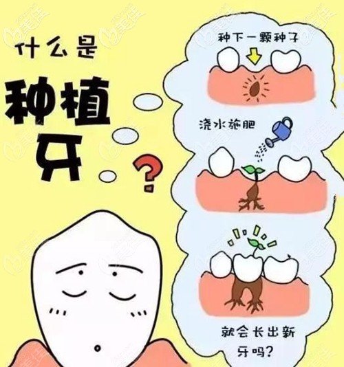<!--<i data=20240703-sp></i>-->醫(yī)生擅長的種植牙項(xiàng)目