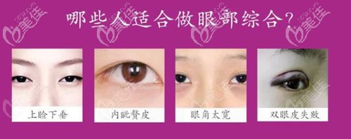 適合做眼綜合的人