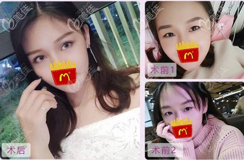 張家口維多利亞眼綜合案例