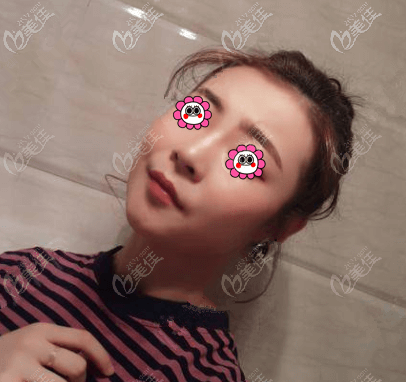 我做V美減齡V3定格青春術(shù)有26天了 我做V美減齡V3定格青春術(shù)有26天了