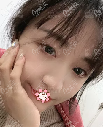 術(shù)前的樣子 術(shù)前的樣子