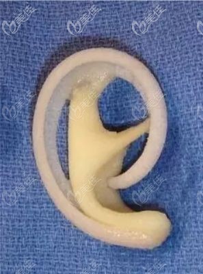 medpor曼特波耳支架模型 medpor曼特波耳支架模型