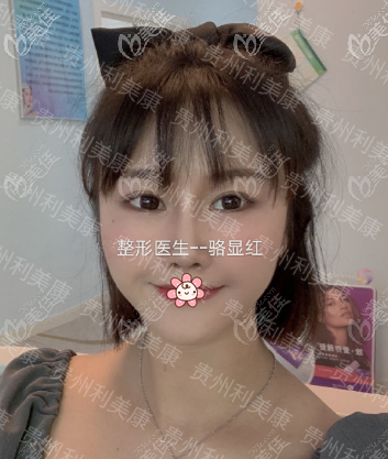 半肋骨鼻綜合4萬(wàn)夠嗎？在做鼻子不一定用完！