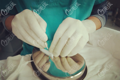 劉醫(yī)生在雕刻假體形狀