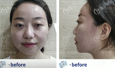 術(shù)前臉的樣子 術(shù)前臉的樣子