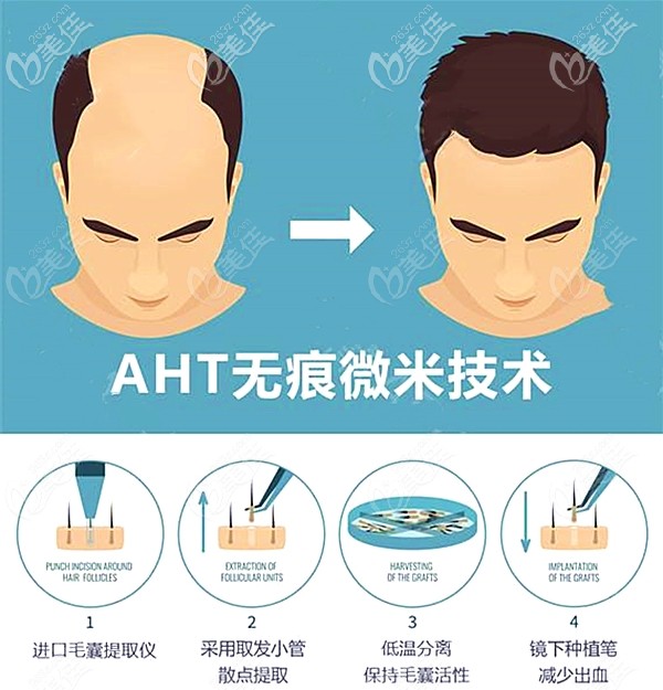 aht納米無(wú)痕植發(fā)技術(shù)