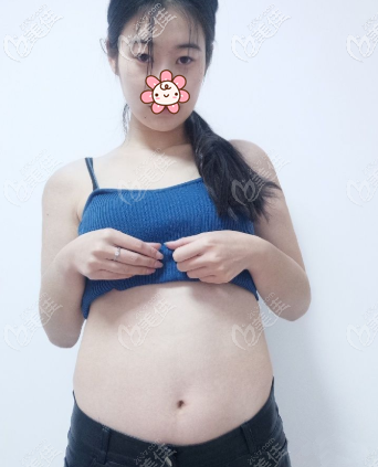 我原來的肚子 我原來的肚子