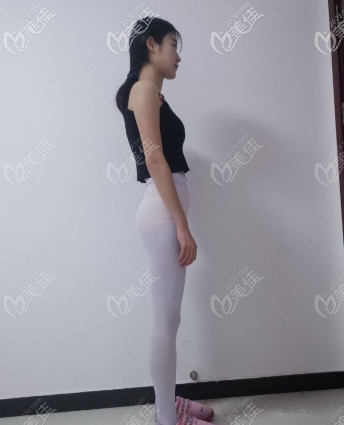 3個月后肚子小了很多 3個月后肚子小了很多