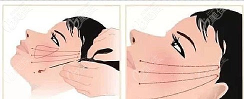 V8埋線提升原理圖解