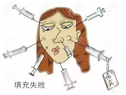 注射玻尿酸填充失敗