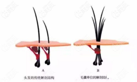 頭發(fā)毛囊單位的解刨結(jié)構圖
