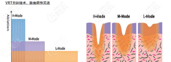 菲蜜麗的脈寬可以靈活調(diào)節(jié) 菲蜜麗的脈寬可以靈活調(diào)節(jié)