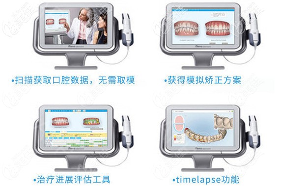 牙博士做隱適美iTreo口掃智能矯牙