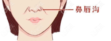 鼻唇溝示意圖