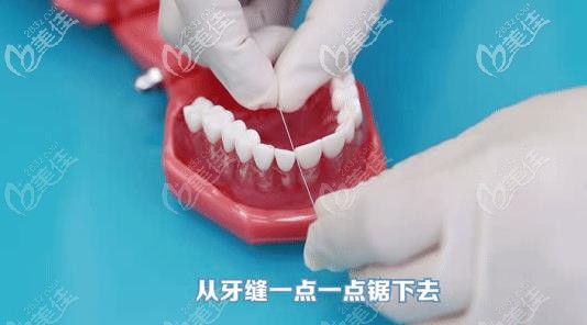 牙線使用第二步