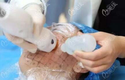 面部熱瑪吉除皺美膚治療