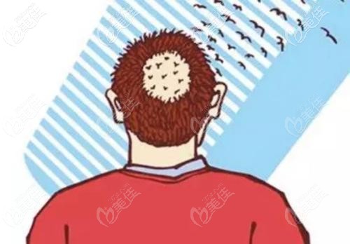 疤痕植發(fā)的價格是多少