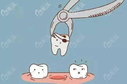 牙齒矯正要拔牙嗎