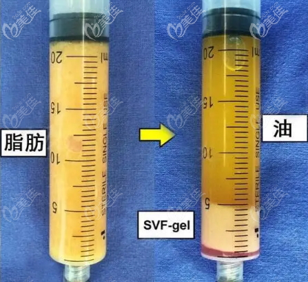 脂肪膠提取