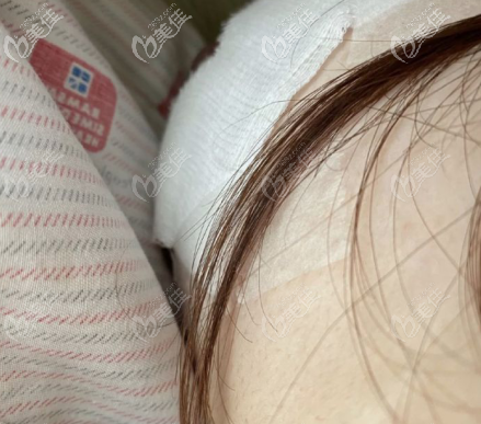 乳暈貼著紗布的樣子