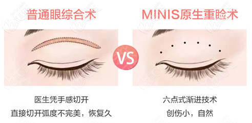 青島華顏美m(xù)inis眼部整形