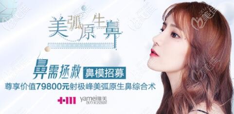 長沙雅美射極峰高端鼻綜合招募鼻模特詳情