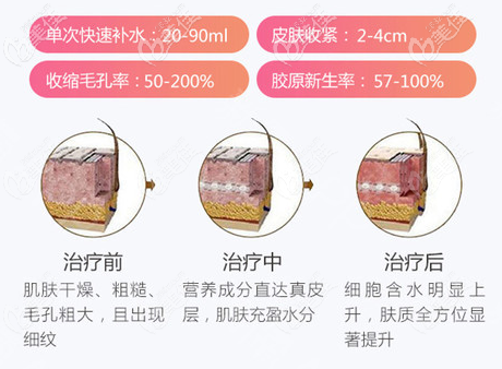 青春解碼儀的治療效果 青春解碼儀的治療效果