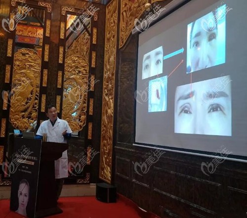 張誠親臨會場講解眼整形規(guī)范標準化.jpg 張誠親臨會場講解眼整形規(guī)范標準化.jpg