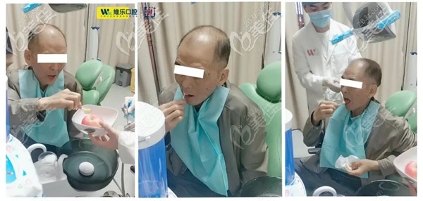 帶上臨時牙冠當(dāng)場試吃蘋果無壓力