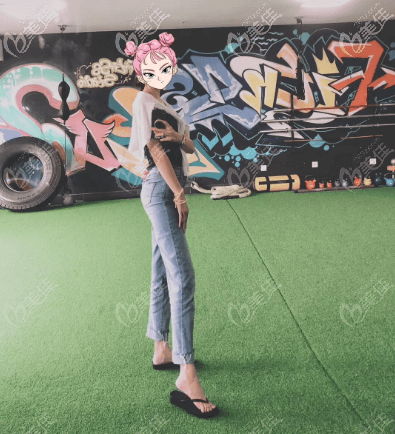 做腰腹分層吸脂術(shù)恢復(fù)時間比我預(yù)期快一點