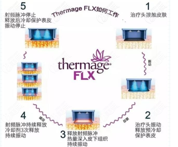熱瑪吉五代和四代對(duì)比效果優(yōu)勢(shì) 熱瑪吉五代和四代對(duì)比效果優(yōu)勢(shì)