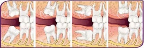 蕪湖美臣口腔拔牙價(jià)格不會(huì)太高