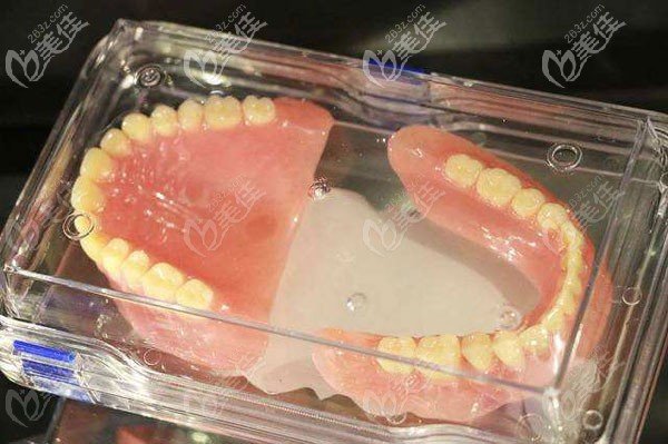 吸附性義齒價格是多少