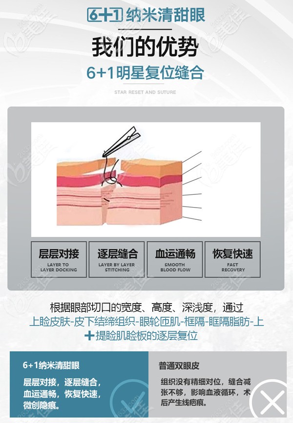 成都東籬醫(yī)院6+1納米清甜眼技術(shù)優(yōu)勢(shì)