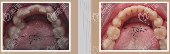 前后對比是不是很明顯呢