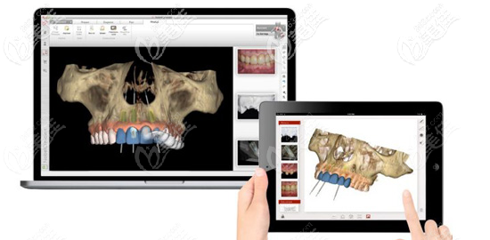 廈門麥芽口腔專業(yè)儀器 廈門麥芽口腔專業(yè)儀器