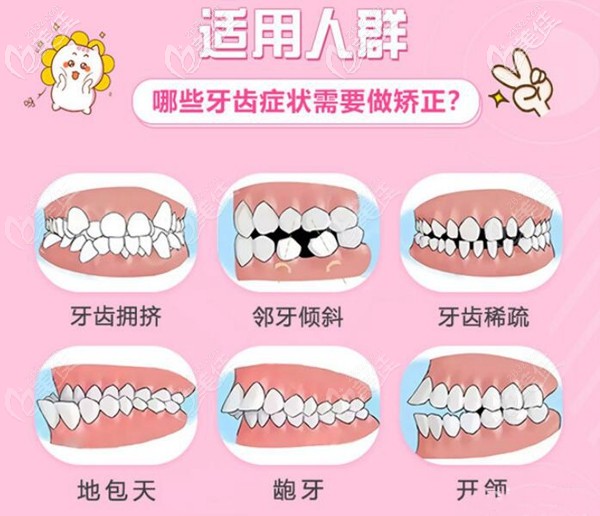 廣州穗江矯正牙齒范圍