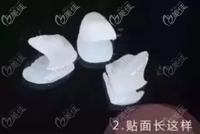 簡(jiǎn)美全瓷貼面超薄
