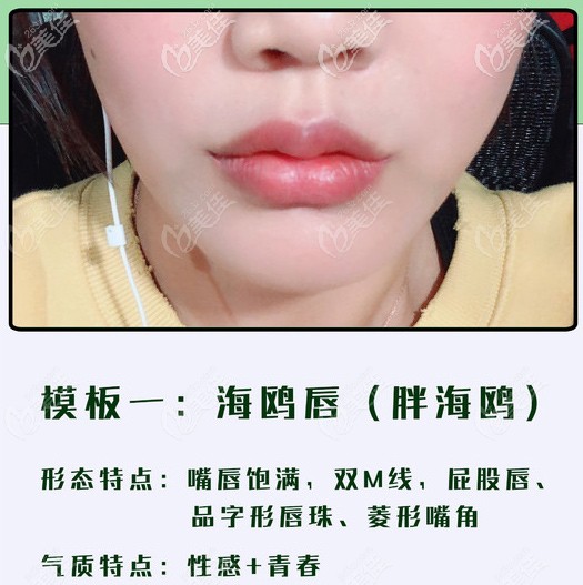 海鷗唇的形態(tài)特點(diǎn)